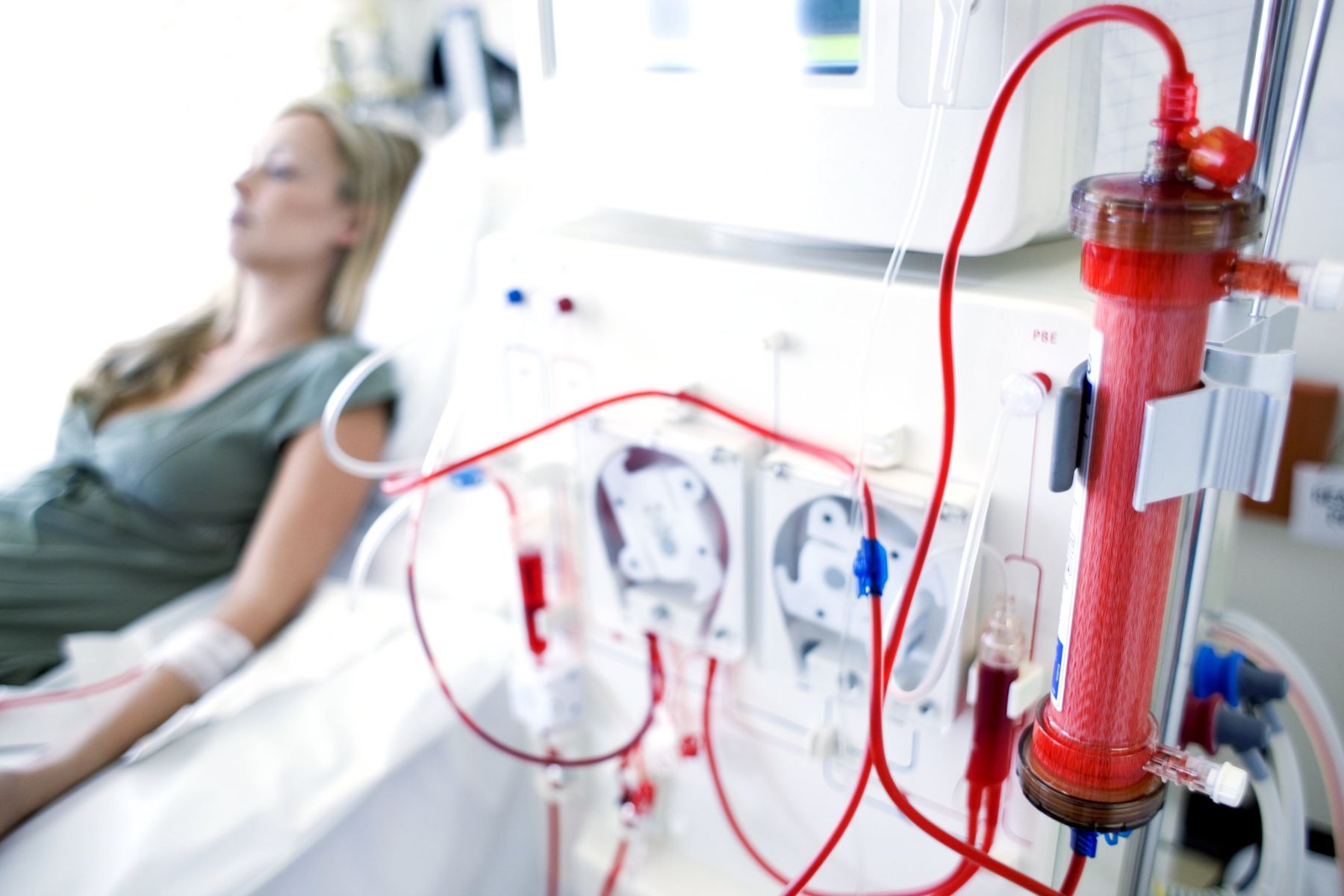 Woman receiving dialysis treatment in hospital.