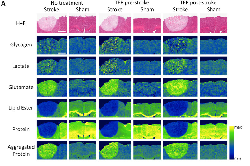 Representative images of FTIR spectroscopic imaging at 24 h post-stroke in non-treated stroke and sham animals, and animals treated with TFP at 30 minute pre-stroke or 1 h post-stroke.