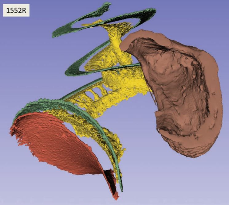 Digital image of an inner ear.