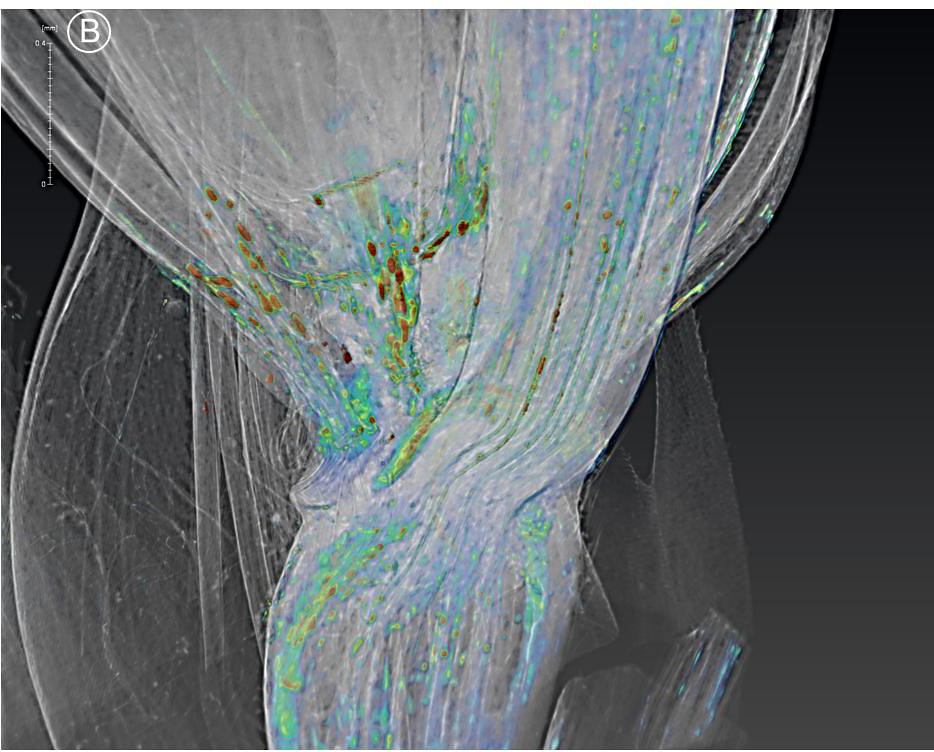 Phase contrast X-ray image of wheat spike highlighting the vascular system