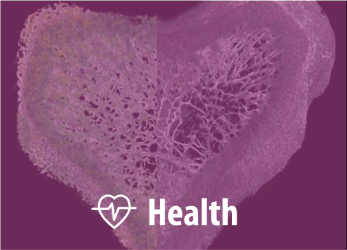Health